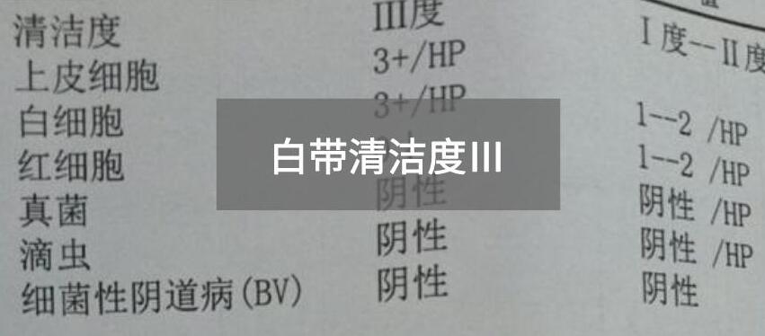 今天快訊！全自動白帶午夜AV剧场生產廠家午夜人妻AV无码為您官方解釋白帶清潔度3的意思