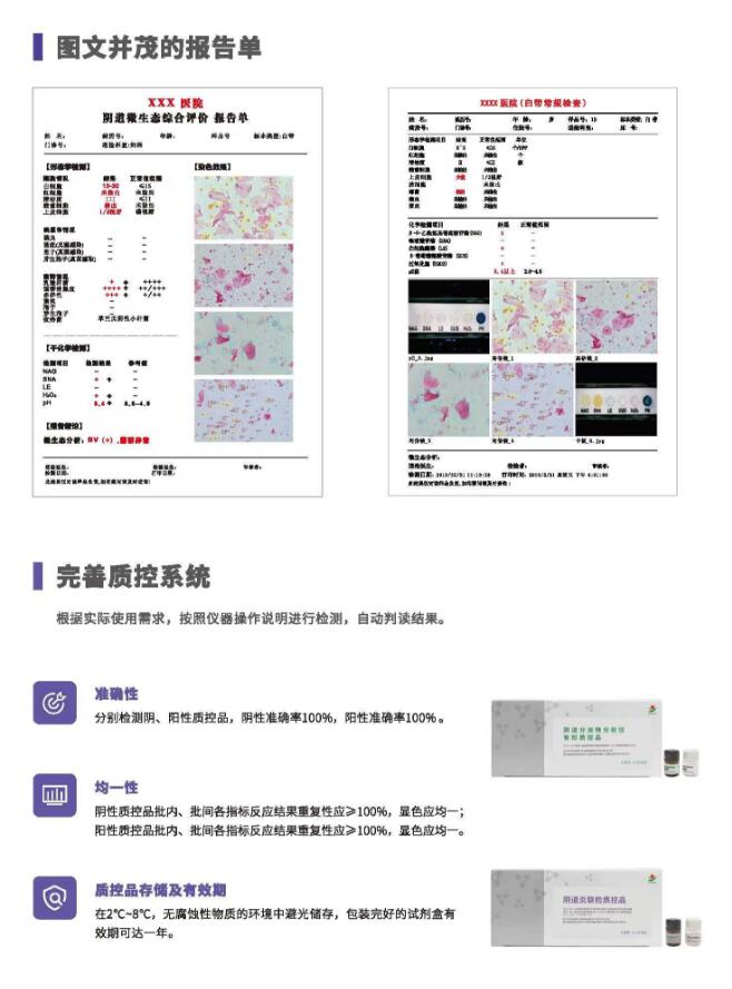 陰道分泌物午夜AV剧场V800報告單